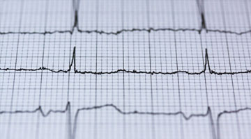 Zo verhoog je je vetverbranding echt